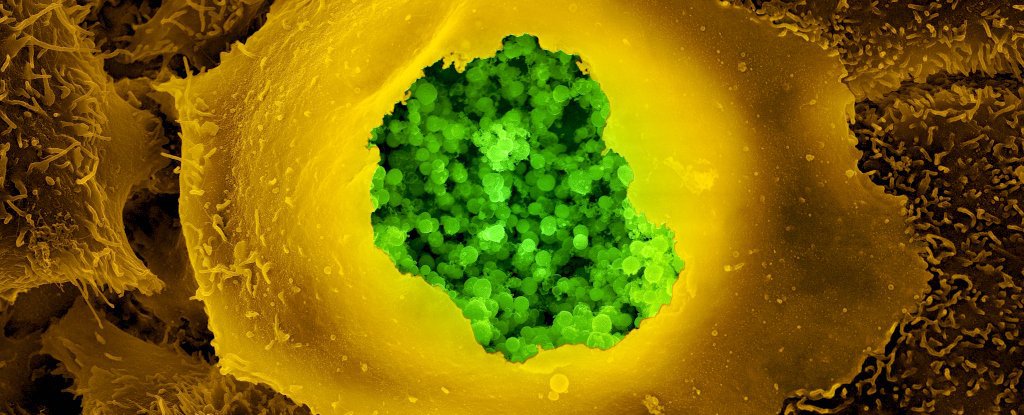 Scientists identify a virus and two bacteria that could be causing Alzheimer’s – ScienceAlert