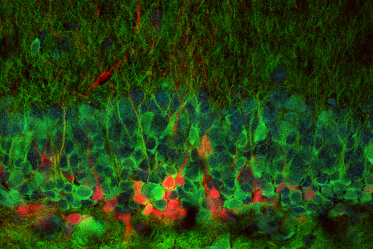 Newborn neurons observed in a live brain for first time | New Scientist