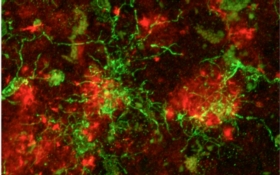 Uncovering New Players in the Fight Against Alzheimer’s