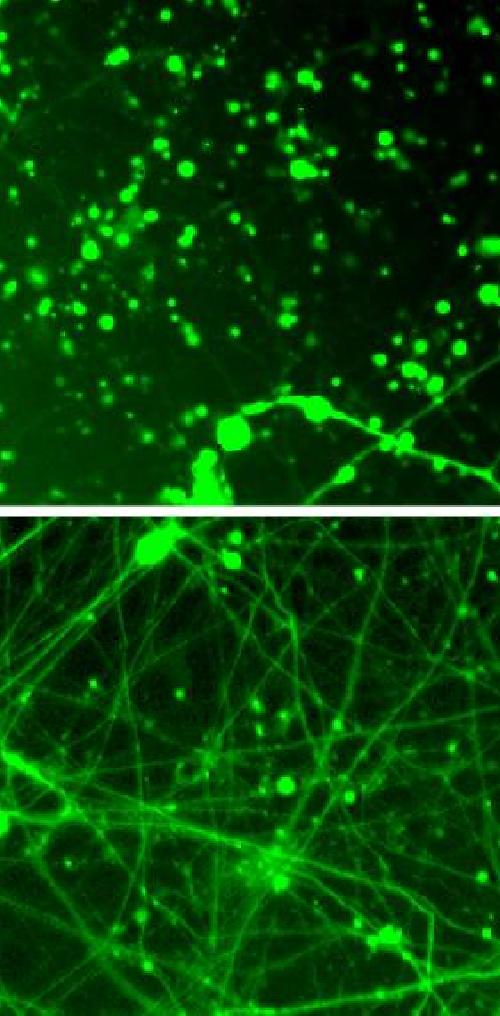 Tamping down neurons’ energy use could treat neurodegeneration | Science Codex